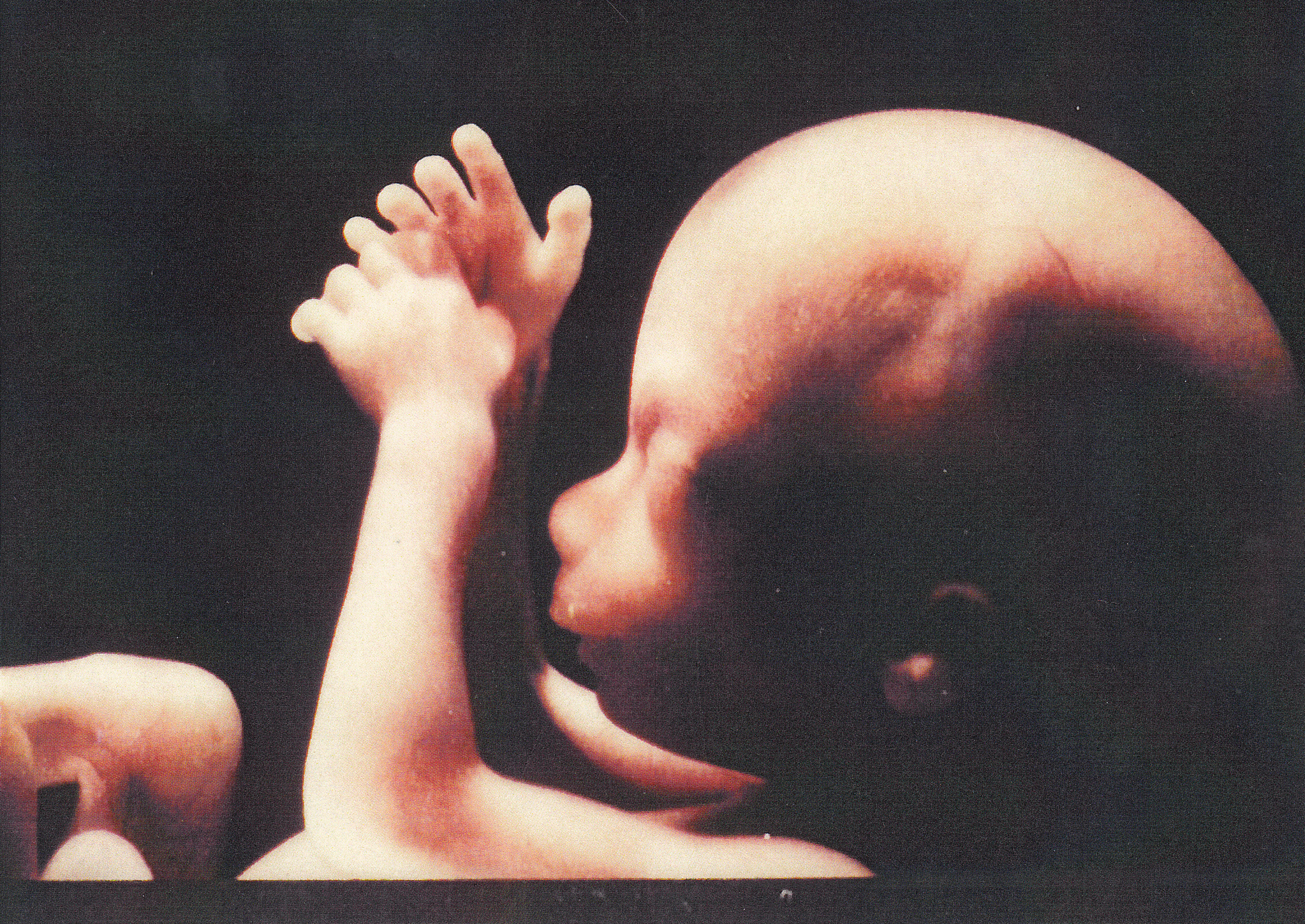 fetus-with-arms-raised